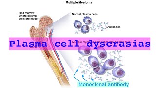 plasma cell dyscrasias [upl. by Tebzil]