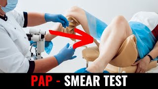 Pap  smear test [upl. by Hayn]