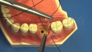 Surgical Technique  Figure of Eight Close Vertical Dental amp Medical Suturing by Stuart OrtonJones [upl. by Galang238]