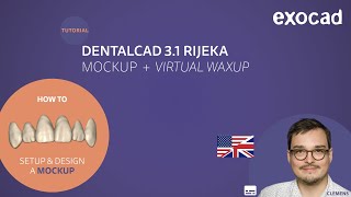 Mockup amp Virtual Waxup VIDEO TUTORIAL [upl. by Eimarej762]