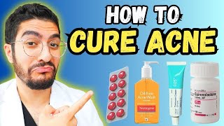 99 Overlook These Effective Acne Treatments – 2024 Guide [upl. by Annotahs62]