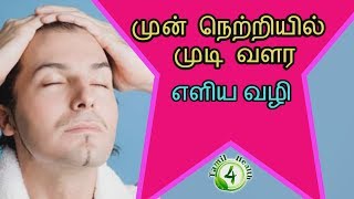 முன் நெற்றியில் முடிவளர எளியவழி hair growth tamil [upl. by Heger]