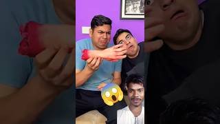 Watermelon🍉💪😲He BROKE HIS HAND SHORTS challenge fruit watermelon shorts [upl. by Eintruok]