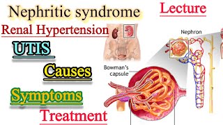 Nephritic syndromeUrinary Tract infectionsRenal Hypertensioncauses SymptomsTreatment [upl. by Ailahtan]