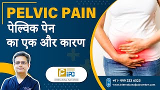 Pelvic Pain का एक और कारण  Explained by Dr Amod Manocha [upl. by Mercer]