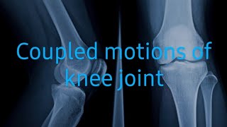 Knee joint MotionsOsteokinematics and Arthrokinematics [upl. by Enimasaj]