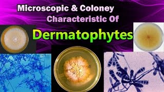 Morphology amp Colony Characteristic Of Dermatophytes [upl. by Dorelle]