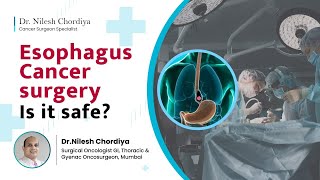 Is esophagus cancer surgery safe  Esophagus cancer  Cancer surgery   Dr Nilesh Chordiya [upl. by Beasley]