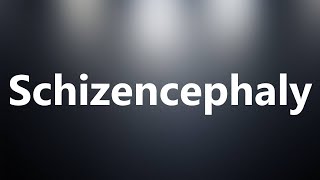 Schizencephaly  Medical Meaning and Pronunciation [upl. by Noxin]