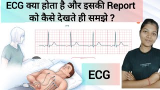 ECG Report कैसे देखते है  How to Check ECG Report  In Detail education [upl. by Xuaegram]