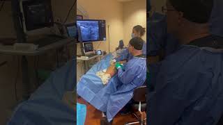 Ultrasound Guided Sclerotherapy Being Performed [upl. by Erreipnaej]