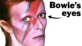 The embarrassing story behind David Bowies eyes [upl. by Nahallac]