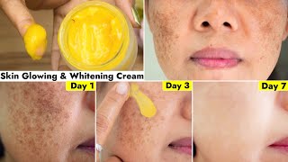 This👆🏼Face Cream Cleared Pigmentation in 3 UsesRemove Dark Spots amp Uneven Skin Get Even Fair Skin [upl. by Akiem547]