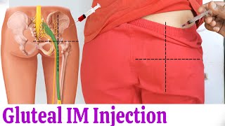 How to give IM Intramuscular injection in buttock or hip easily at home  Dorsogluteal Injection [upl. by Launce]