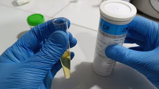 laboratory process for urine analysis [upl. by Ellsworth]