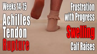 Achilles Tendon Rupture NonSurgical Recovery  Weeks 1415 Slow and Frustrating Progress [upl. by Edas269]