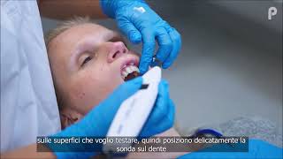 Digitest 3 ITA Strumento per la vitalità dei denti a cura del Dr Sjobbe Besseling [upl. by Kally]