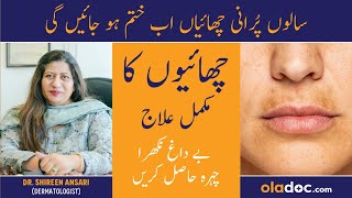 GET RID OF PIGMENTATION  Chaiyan Khatam Karne Ka Tarika  Melasma Aur Pigmentation Ka Ilaj [upl. by Ahsemat68]