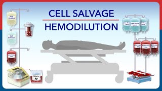 Cell Salvage and Hemodilution [upl. by Nuri]