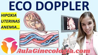 ECO DOPPLER EN OBSTETRICIA HIPOXIA ARTERIAS UTERINAS ANEMIA FETAL  Ginecología y Obstetricia [upl. by Pierre898]