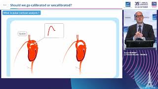 Pulse contour analysis Should we go calibrated or uncalibrated [upl. by Nomyaw]