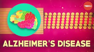 What is Alzheimers disease  Ivan Seah Yu Jun [upl. by Enelyw]