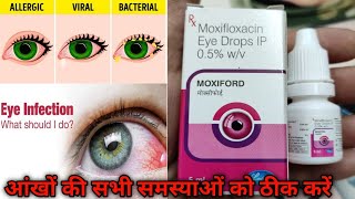 Moxiford Eye Drop Review  Moxifloxacin  Uses and Benefits  And How To Use  In Hindi [upl. by Ancier]