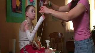 EJ had Epidermolysis Bullosa EB  quotThe Worst Disease Youve Never Heard Ofquot [upl. by Neilson]