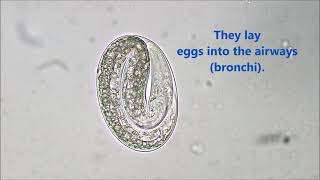 Dictyocaulus viviparus egg Bovine Lungworm quotHoosequot [upl. by Tristas]