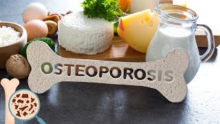 Osteoporosis  Everything You Need To Know [upl. by Acenom]