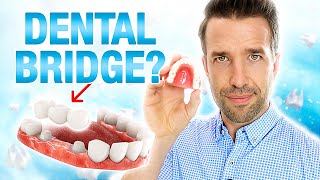 You Need to Know This About a Dental Bridge [upl. by Niram9]