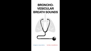 Bronchovesicular Breath Sounds [upl. by Niwrud]