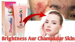 Dermadew Caloe Lotion hindi Review Iska Kam Kya Hai Side Effects Uses  benefits digitalmedilife [upl. by Enniroc412]