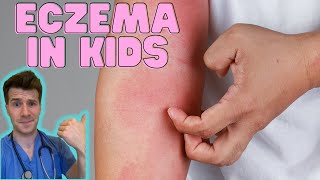 Everything you need to know about Eczema in kids Causes symptoms treatment amp home management [upl. by Aloeda]