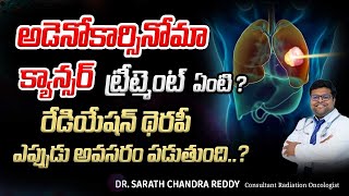 Esophageal cancer  Adenocarcinoma CANCER treatment  DrSarath Chandra Reddy  Kaizen Hematology [upl. by Ayanahs]