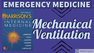 MECHANICAL VENTILATION  Basics  Types  Modes  Indications  Complications  Weaning  Harrison [upl. by Marilou]