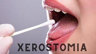 Xerostomia Causes and Clinical Features [upl. by Yelnek]