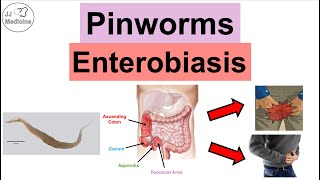 Pinworms Enterobiasis  Infection Transmission Symptoms Diagnosis Treatment [upl. by Leagiba626]