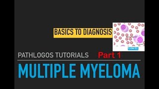 Multiple myeloma Pathology lecture Part 1 [upl. by Lundgren]