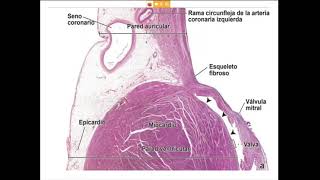 Caracteristicas funcionales y morfologicas del Endocardio Miocardio y Pericardio [upl. by Ariadne]