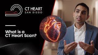 What Is A CT Heart Scan [upl. by Iat5]