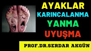 Ayaklarda Karıncalanma İğne batması Uyuşma Üşüme Yanma neden olur Serdar Akgün Sağlıklı Yaşam [upl. by Sudnak]