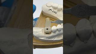 Zen Enamel Molar Implant lsk121shorts dentist teeth [upl. by Gerek]