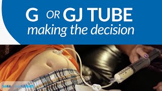 The GGJ Tube Decision [upl. by Guillemette]