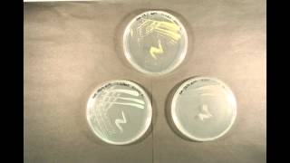 Bacterial Growth time lapse [upl. by Idonna]