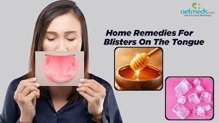 Blisters On The Tongue 6 Effective Home Remedies [upl. by Ilahsiav]