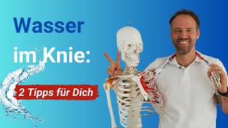 Warum schwillt mein Knie an ➡️ 2 konkrete Tipps gegen Wasser im ArthroseKnie [upl. by Hughie192]