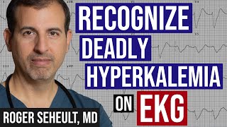 Hyperkalemia  Peaked TWaves  and ECG Recognition [upl. by Kimberlyn856]