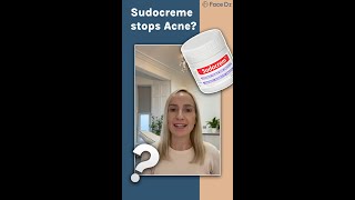 Does Sudocrem clear Acne [upl. by Seraphine]