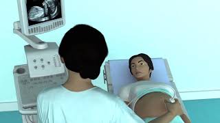 The Basic Steps of an Obstetric Ultrasound Examination [upl. by Candyce]